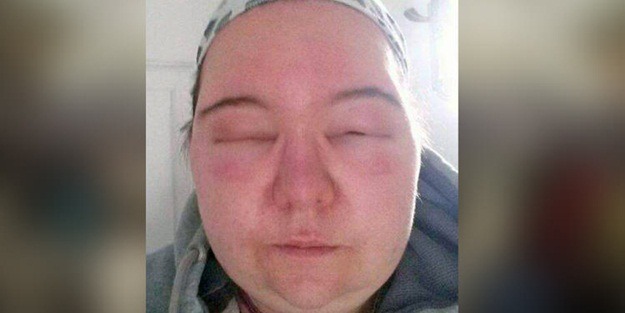 Saç boyası öldürüyordu!