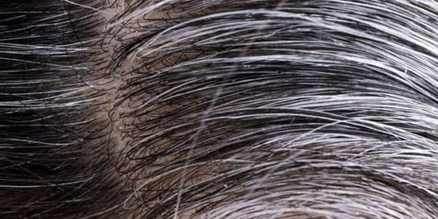 Saç diplerindeki iltihaplanmayı bitiriyor! Beyaz saçlar evde nasıl kapatılır? Yok edecek formül