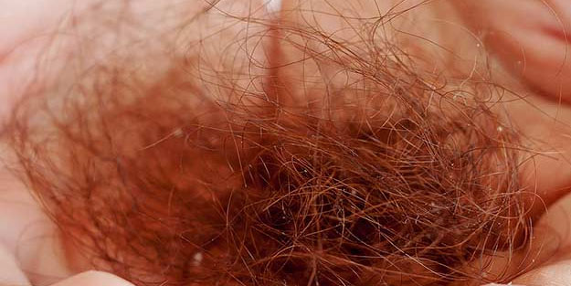 Saç dökülmesi için bıttım Sabunu: öyle bir şey