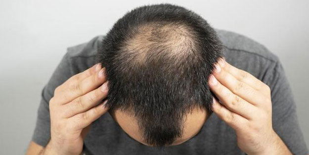 Saç dökülmesini azaltan 4 muhteşem yöntem