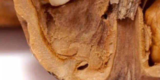 Saç dökülmesini durdurduğu kanıtlandı: Çöp diye attığımız hazine elimizin altındaymış! Saniyede 1 kez en az yapın...