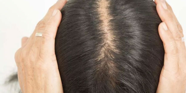 Saç dökülmesini engelleyen besinler
