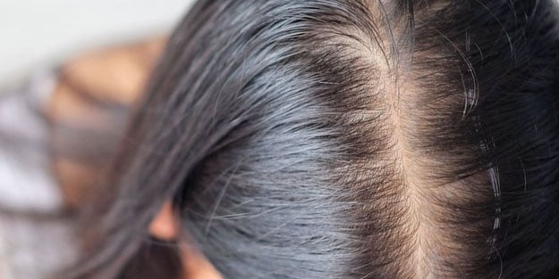 Saç dökülmesini hayatınızdan komple çıkaran bu tarifi mutlaka denemelisiniz