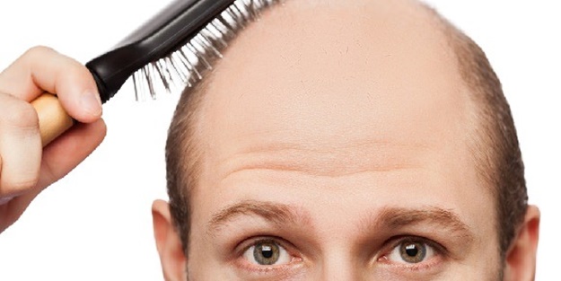 Saç dökülmesini önlemek istiyorsanız...