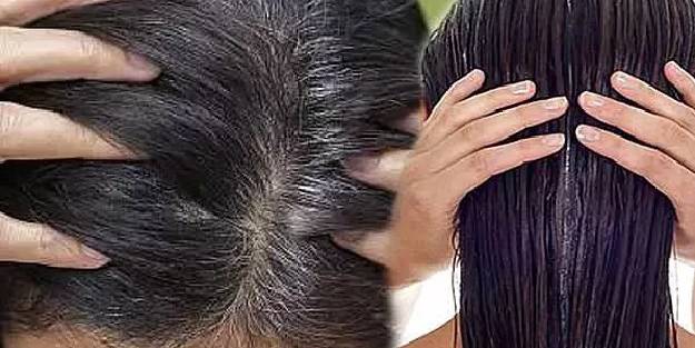 Saç kızarıklığı ve kaşıntısına ne iyi gelir?