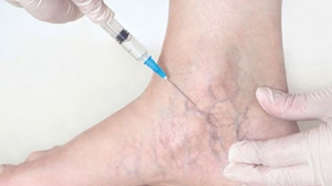 Saç ve ayak derisine nefes aldırıyor, doğal mantar kremi, 5 dakika bekletmek yetiyor