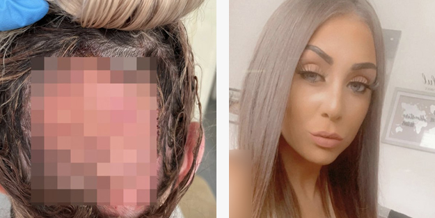 Saçını boyatmak isteyen genç kadın kuaförde kabusu yaşadı