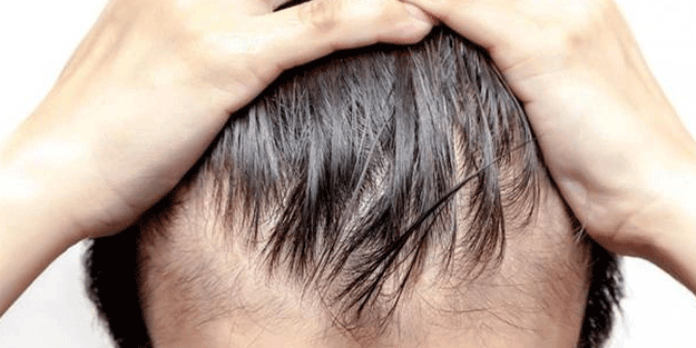  Saçınıza nane ve hindistan cevizi yağı sürerseniz...