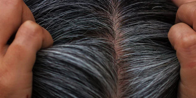 Saçlardaki Beyazlıklar Nasıl Kapatılır? Beyaz saçları 1 gecede özüne döndürüyor