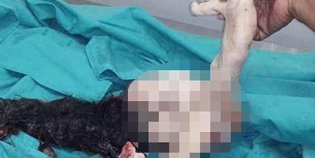 Saçları, bacakları var ama 15 yıl sonra doğdu!