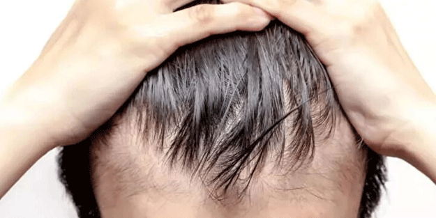 Saçları dökülenler bu habere dikkat: Bir avuç tüketmek bile etki ediyor