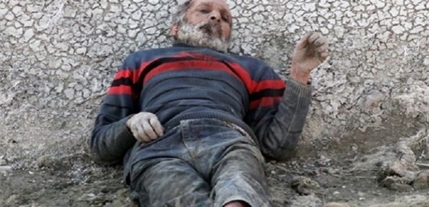 Yiyecek bir şey bulamayınca saçlarını yedi