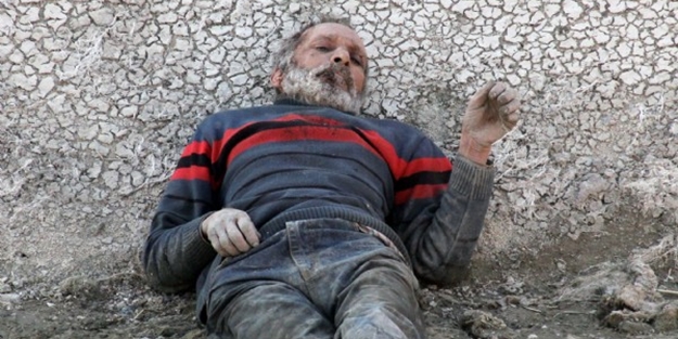 Saçlarını yiyerek hayatta kaldı!