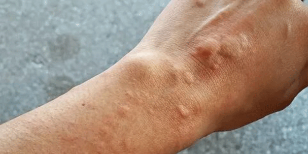 Sadece Ordu, Samsun, Giresun Tokat ve Sivas değil tüm Türkiye tehlikede 4,5 kat arttı Gece ortaya çıkıyor