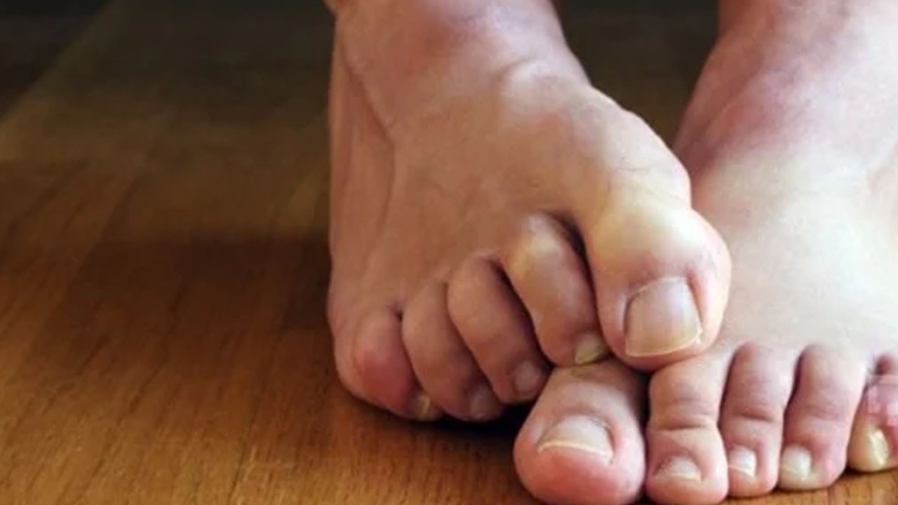 Sağ ayakta uyuşma devamlı ise tehlikeli ortaya çıktı! Tehlike büyük