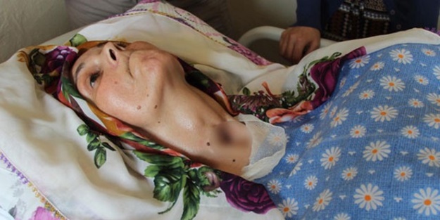 Sağlam girdiği hastaneden yatalak olarak çıktı!