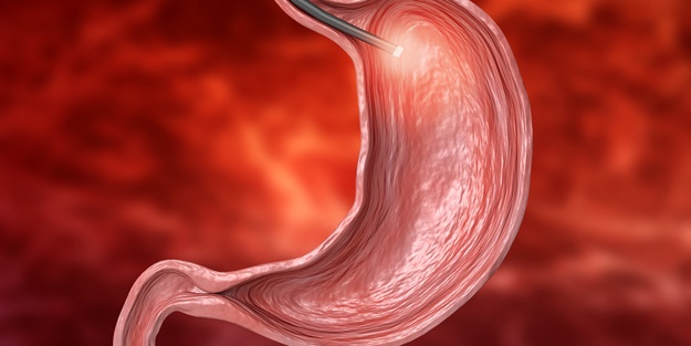 Sağlık Bakanlığından 'mide botoksu' açıklaması! Soruşturma başlatıldı