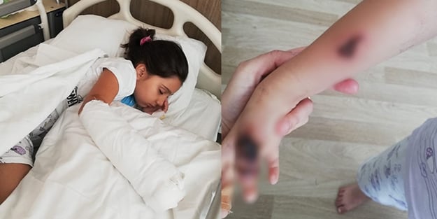 Sağlık skandalı: 6 yaşındaki küçük kızı MR çekiminde yaktılar!