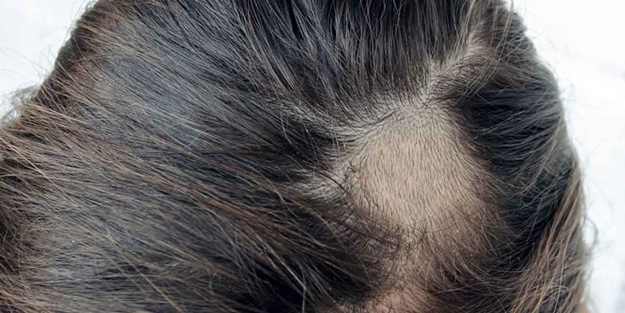 Sağlıksız saçların sebebi olabilir! Sakın bunu yapmayın