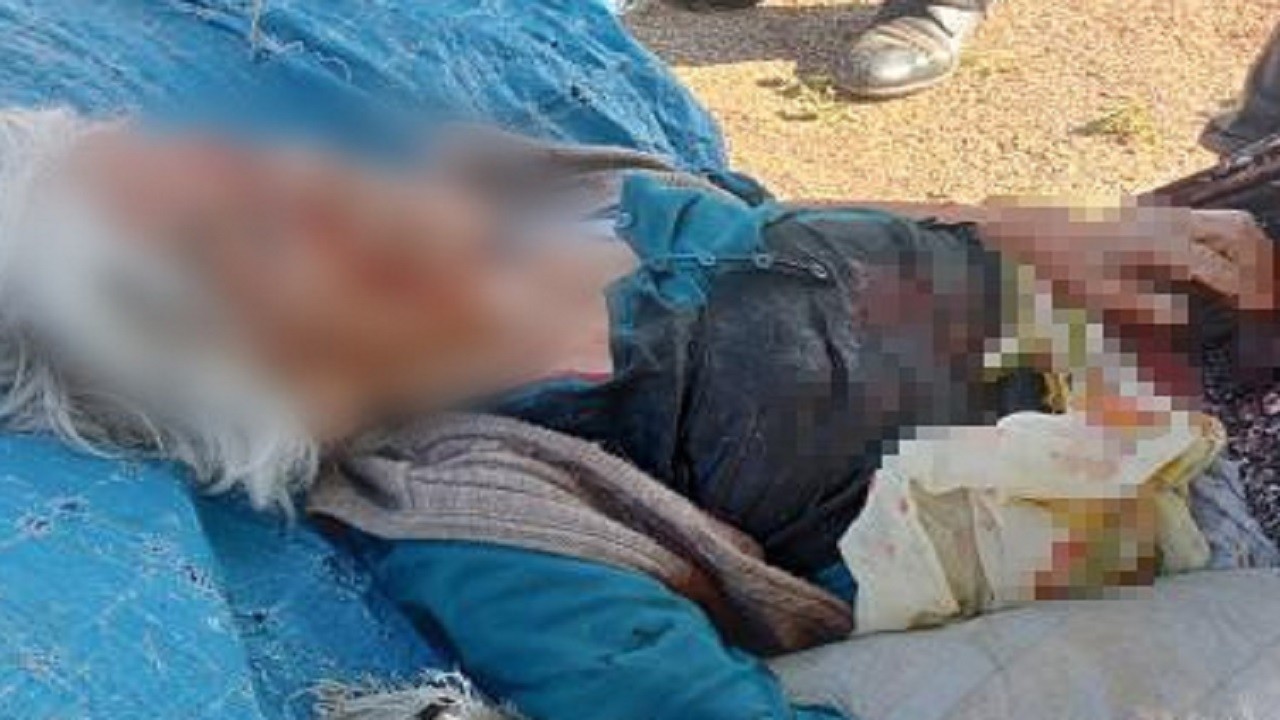 Sahipsiz köpek yaşlı kadını ağır yaraladı