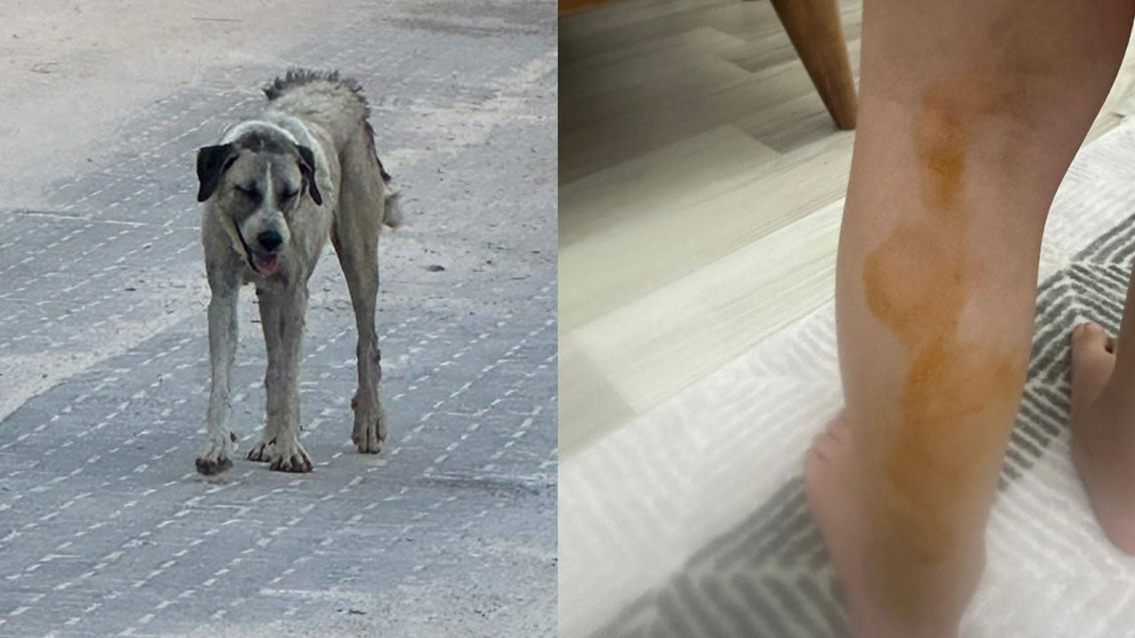 Sahipsiz sokak köpeği annesiyle yürüyen 3 yaşındaki çocuğa saldırdı