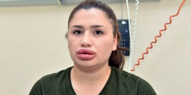 Sahte estetikçi kuaföre bir şok daha