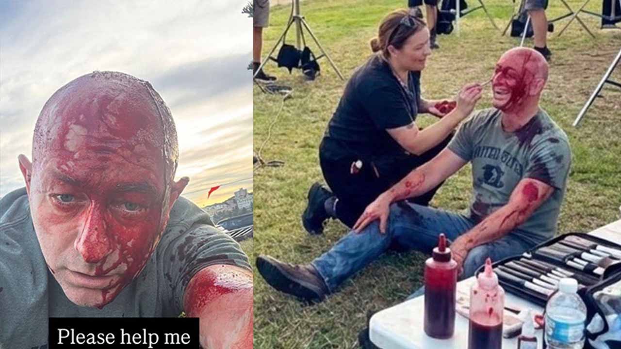 Sahte yarayla mağduriyet oyunu! Gerçek sonradan ortaya çıktı