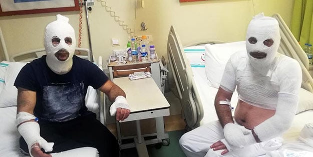 Şaka gibi olay! Tinerle temizlik yaparken sigara yaktı olanlar oldu