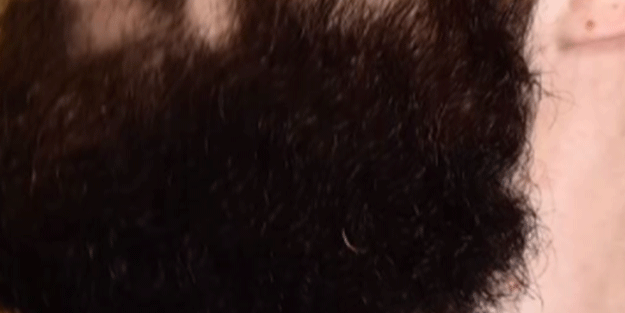 Sakalını koparanlar dikkat! Nasıl olur? İşte en kolay yöntemler…