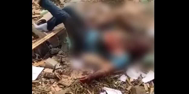 Sakarya'daki patlamada yaralanan adamın görüntüleri patlamanın şiddetini gözler önüne serdi