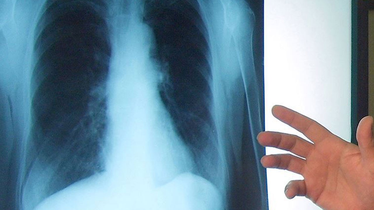 Sakın görmezden gelmeyin! Bu hastalık sinsice ilerliyor