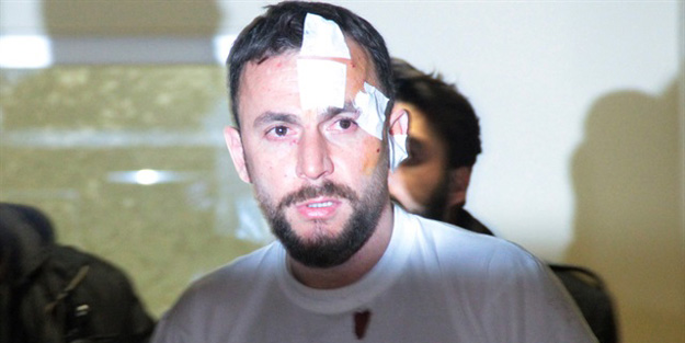 Saldırıda yaralanan kişi konuştu