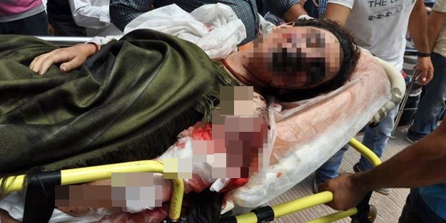 Saldırıda flaş gelişme: Karnında bulundu