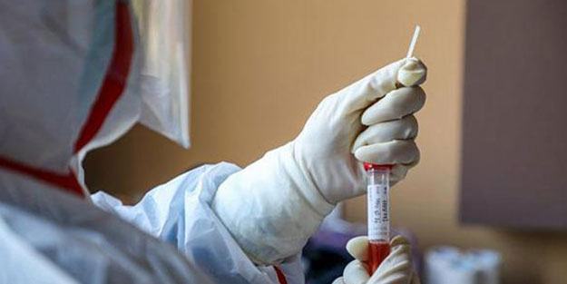 Salgına karşı aşı ve tedavide ışık göründü! “Koronavirüsün zayıf noktasını bulduk”