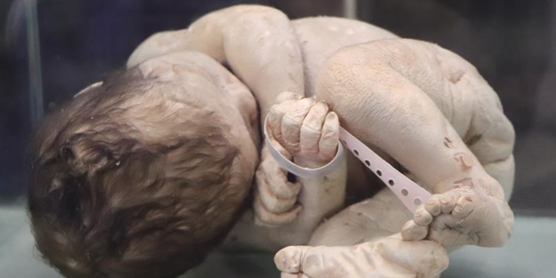 Samsun'da bu müzeye giren şaşkına dönüyor! Bu halde sergileniyorlar! Asırlık cerrahi aletler bu müzede