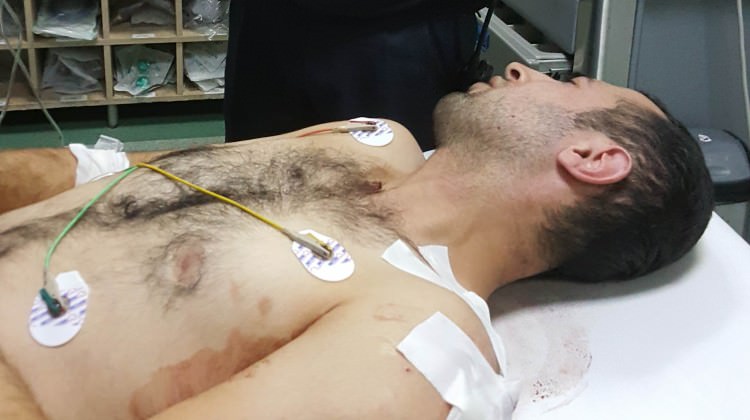 Samsun'da silahlı saldırı: 1 kişi yaralandı