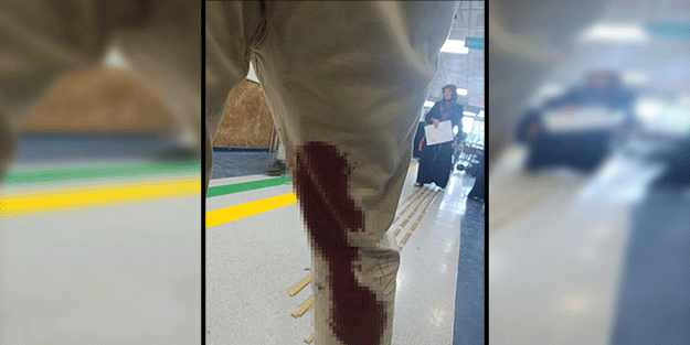 Bu yaralanmaya sözde hayvanseverler sebep oldu!