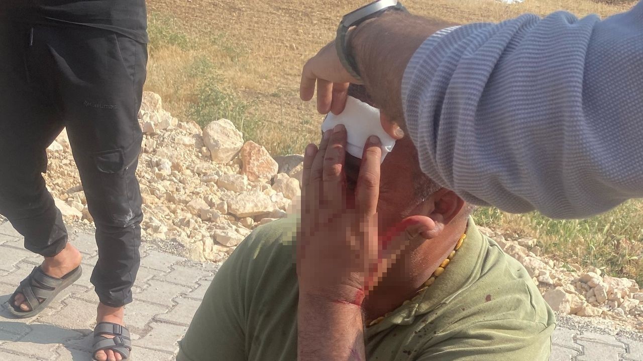 Şanlıurfa'da çocukların kavgasına büyükler karıştı: 5 yaralı