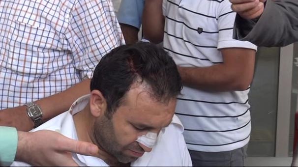 Şanlıurfa’da kaçak su kullanımı ihbarına giden ekip darp edildi
