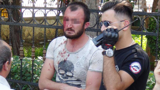 Şanlıurfa'da tekme tokat dövdüler