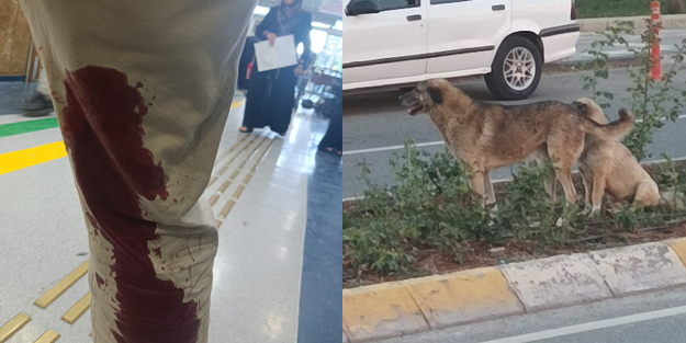 Şanlıurfa’da vatandaşı ısıran köpek kuduz çıktı