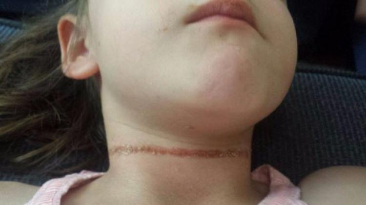 Şapkası ölümüne sebep olacaktı