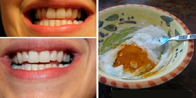 Sararmış dişlere karşı 3 malzemeli mucize!