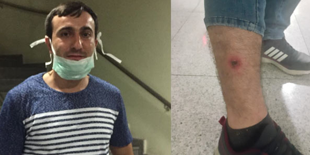 Şarbona yakalanan vatandaş konuştu: Eti yemedim, temas ettim