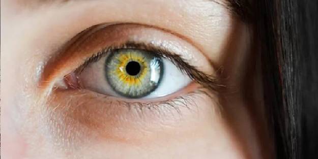  Sarı Nokta hastalığına dikkat