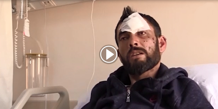 Şarj cihazı patladı! Genç ölümden döndü