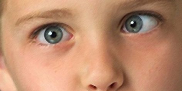 Şaşılığın nedenleri nelerdir?