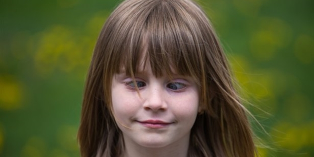 Şaşılık rahatsızlığı nedir?