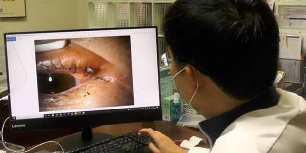 Şaşkına çeviren olay! 13 yaşındaki kızın gözüne kene yapıştı