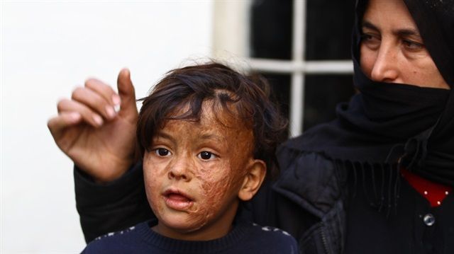 Savaşın izlerini yüzünde taşıyor